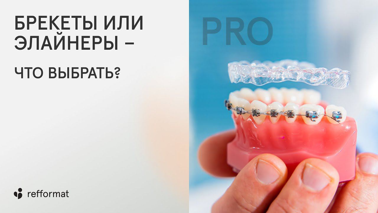 Элайнеры или брекеты: что лучше? смотреть онлайн