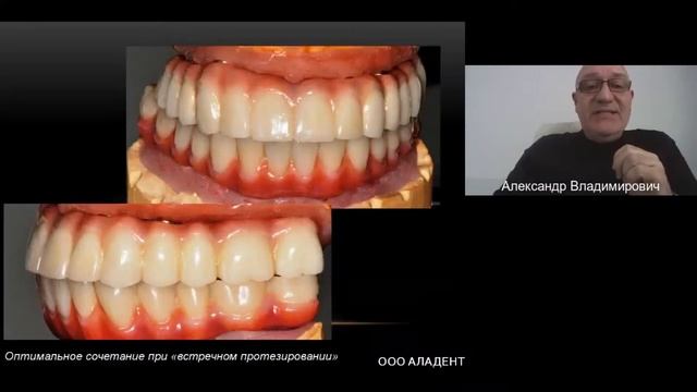 Александр Лазарев.Полимерные материалы и керамо наполненные композиты в изготовлении зубных протезо смотреть онлайн