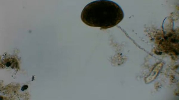 Активный ил под микроскопом. Activated sludge under the microscope