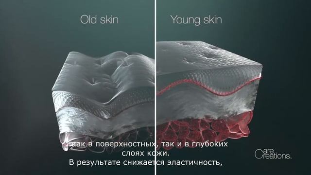 Collalift ® 18 Лифтинг-компонент нового поколения смотреть онлайн