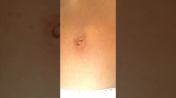 Пирсинг пупочка