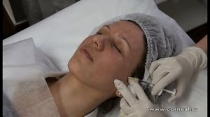 Микроиглы можно ставить после массажа