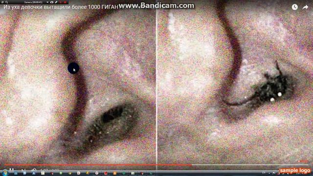 муравьи в ушах шок!!!