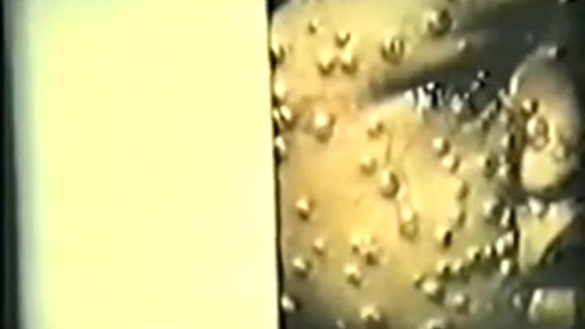 Ветряная оспа 2 смотреть онлайн