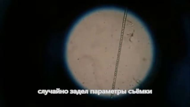 колония в роголистнике (или что там завелось) смотреть онлайн