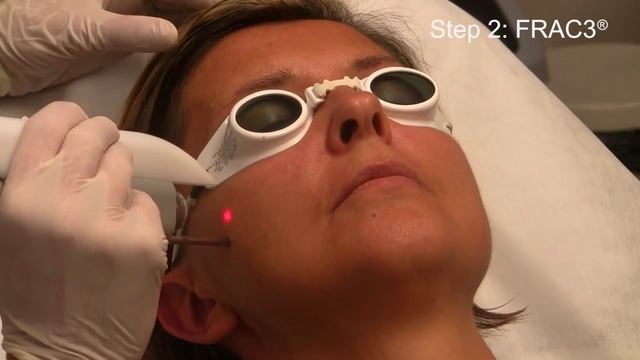 Лазерное 4D в Резиденции Красоты Версаль смотреть онлайн