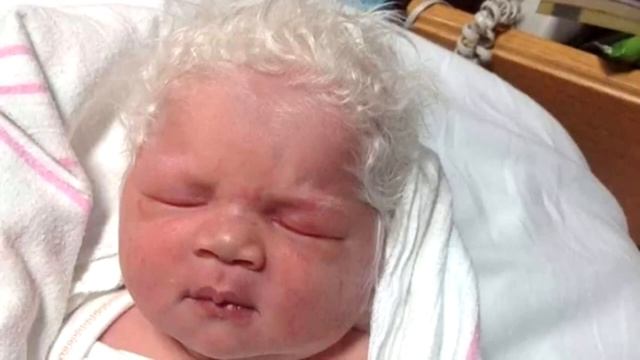 Врачи были в ужасе, когда увидели ребёнка! Такое бывает раз в миллион лет! смотреть онлайн