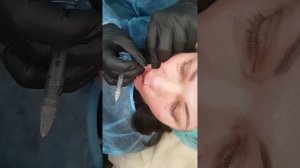 Убираем морщины марионетки.