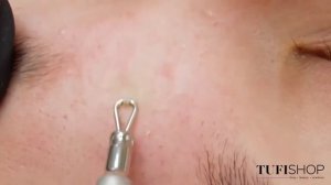 Инструменты для чистки лица