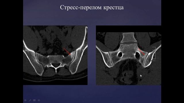 Умение расслабляться