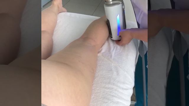 Эндосфера-терапия смотреть онлайн