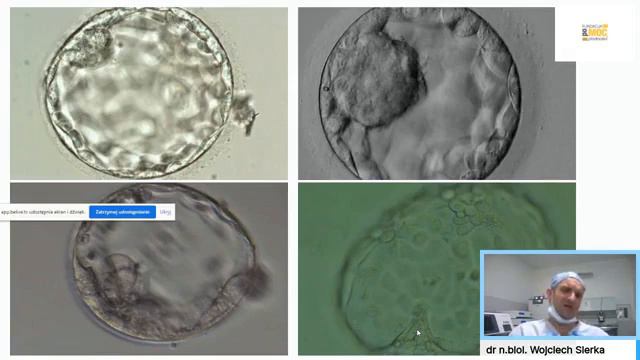 Jak uzyskać dobre zarodki i zwiększyć szanse na udane in vitro - rozmowa z dr n.biol. W. Sierka смотреть онлайн