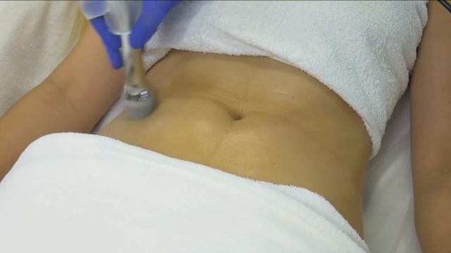 Как бороться с проблемной кожей смотреть онлайн