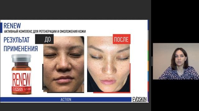 ACTION - Онлайн-семинар по линии активных комплексов EVOSKIN