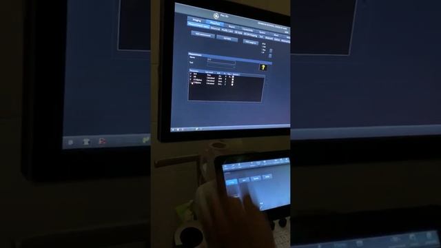 Video 8: Echocardiography/Heart ultrasound/2D смотреть онлайн