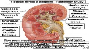 Паренхима почки и ее патологии