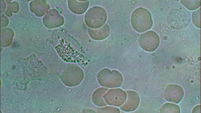 Бакт. 1час 0.75литра щел. воды.avi смотреть онлайн