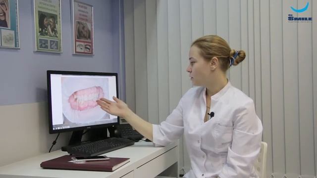 Особенности исправления прикуса в зрелом возрасте. Догару А. М. dr Smile смотреть онлайн