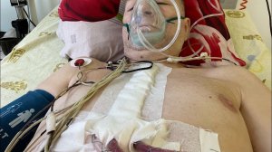 19.08-01.09.2022 операция на открытом Сердце АКШ, МКШ