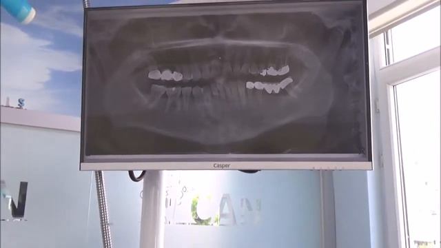 Средиземноморская Улыбка. Стоматология в Анталии. смотреть онлайн