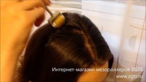 Мезороллер для волос