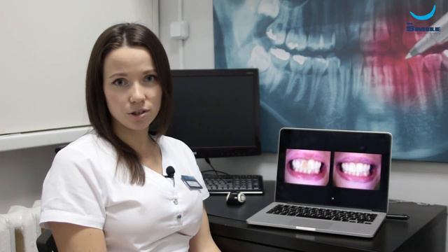 Отбеливание зубов. Сафонова Е.Н. Клиника Dr Smile смотреть онлайн