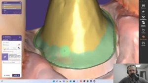 Моделирование полноанатомической коронки в exocad. Моделирование со сканов интраорального сканера