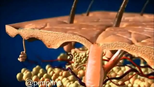 принцип лазерной эпиляции смотреть онлайн