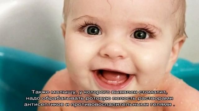 Набухшие десна у грудничка смотреть онлайн