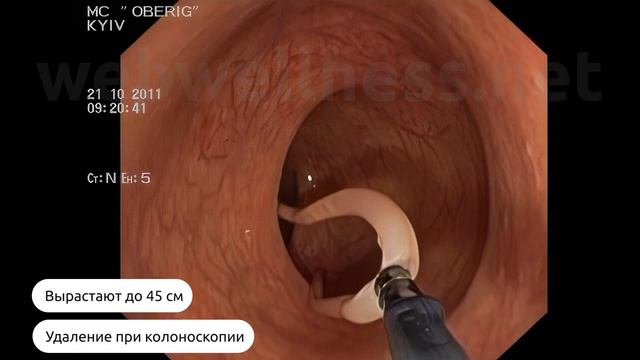 Наглядно, как работает биорезонанс смотреть онлайн
