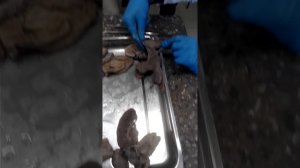 Анатомия матки для медиков