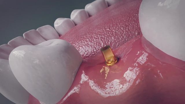 Анимационное 3д видео для стоматологии.