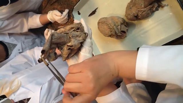 Кровеносная система ч 1 720 смотреть онлайн