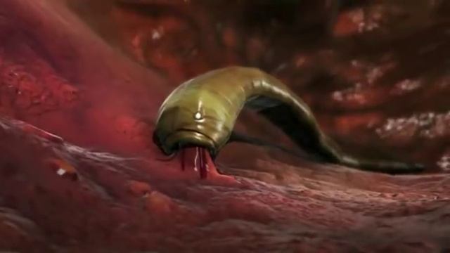 Intestinal Worms смотреть онлайн