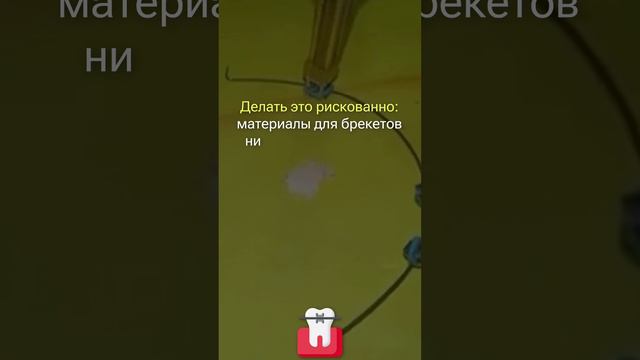 ПОЧЕМУ ОПАСНО НОСИТЬ ФАЛЬШИВЫЕ БРЕКЕТЫ? РАЗБОР ВРЕДА ФЕЙКОВЫХ БРЕКЕТОВ смотреть онлайн