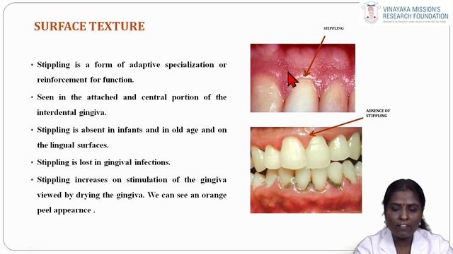 Dr Manovijay Department of Periodontology Case History, Diagnosis and Treatment Plan In Periodo смотреть онлайн