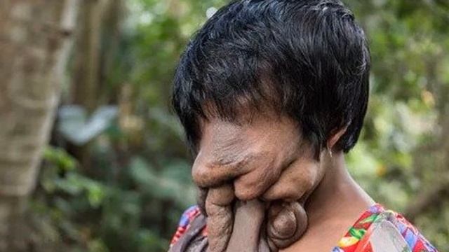 ЖИЗНЬ девушки без ЛИЦА