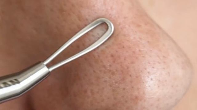 Как очистить поры на лице.Как очистить поры лица смотреть онлайн