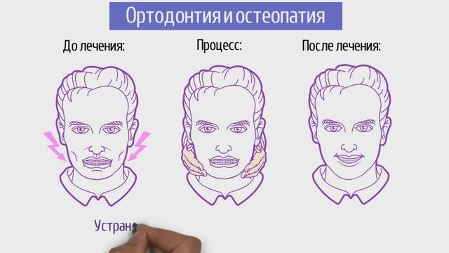 Зачем нужны ЛОР, остеопат, косметолог и логопед в стоматологической клинике? смотреть онлайн