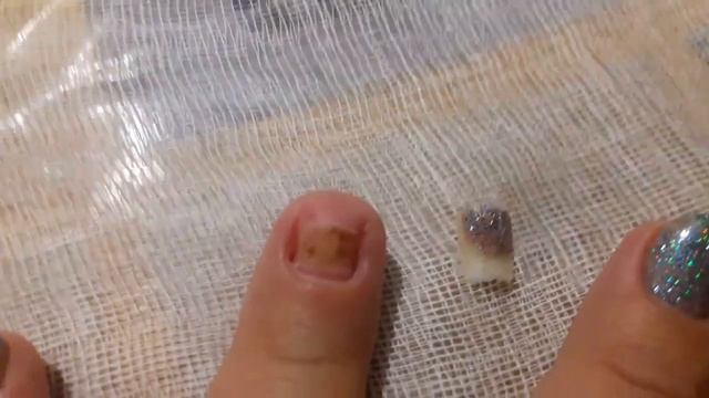 ААА! Очень БОЛЬНО! Сорвала нарощенный ноготь с корнем! Удаление ногтя. Remove nail yourself смотреть онлайн
