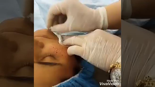 Хиджама.Обучение смотреть онлайн