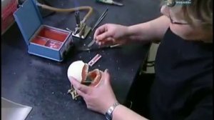 Съемные зубные протезы пластиночные