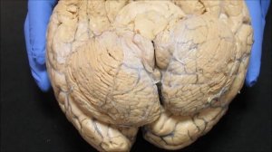 Задний мозг