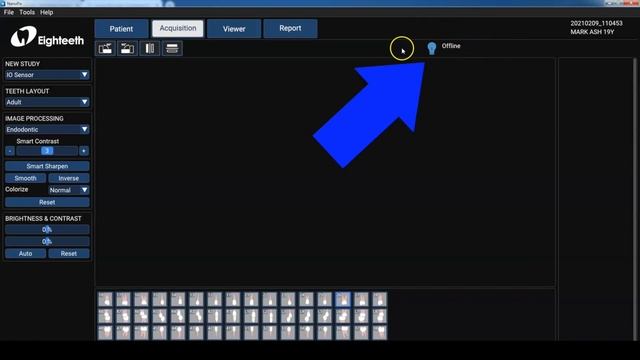 Unboxing and Software Demonstration of Eighteeth Intraoral Digital Sensor NanoPix by Dr.Ash Mark смотреть онлайн