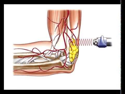 Физиотерапия смотреть онлайн