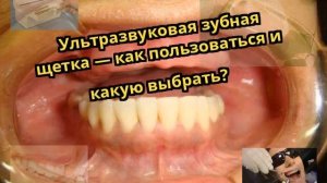 Ультразвуковая зубная щетка — как пользоваться и какую выбрать?