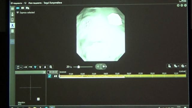 52 Edward J Despott Иванова ЕВ Интерактивный разбор с объяснениями аудитории ряда клинических случа смотреть онлайн