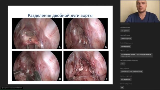 Сосудистые кольца трахеи у детей - Степаненко Н.С. смотреть онлайн