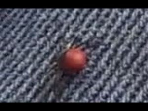 Энцефалитный КЛЕЩ НАДУВАЕТСЯ и ЛОПАЕТСЯ в ОГНЕ - Это ВЫРЕЗКА из ФИЛЬМА ВСЕ О Клещах ссылка вОписании