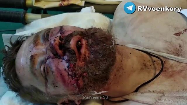 «Ореховская мясорубка»: из 120 солдат ВСУ осталось 3!
Российские военные медики в свой профессиональ смотреть онлайн